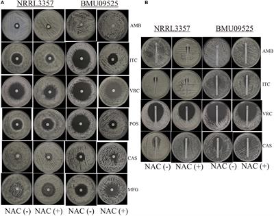 The Elevated Endogenous Reactive Oxygen Species Contribute to the Sensitivity of the Amphotericin B-Resistant Isolate of Aspergillus flavus to Triazoles and Echinocandins